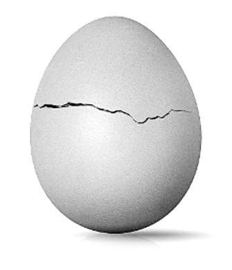 Guia Morte Súbita inc. para a Verdadeira Vontade